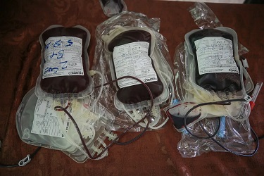 Ahli Hematologi Onkologi: 1 Pendonor Darah Bisa Selamatkan Tiga Nyawa